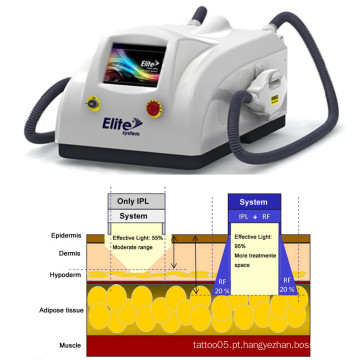 Remoção de Pêlos Rejuvenescimento da Pele Sistema E-Light Smq-Eg Beleza Equipamento